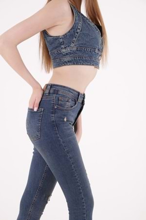 Yüksek Bel Az Yırtıklı Lazerli Skinny Kot Pantolon 826-02-(28-33) Koyu Tintli Kot