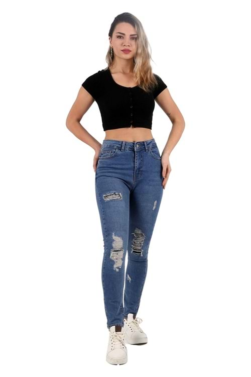 Yüksek Bel Lazerli Skinny Kot Pantolon 883-06-(26-31) Orta Mavi Kot